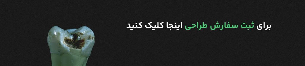 طراحی دیجیتال دندان